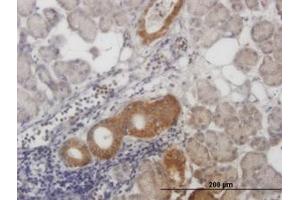 Image no. 6 for anti-Calcium Responsive Transcription Factor (CARF) (AA 621-719) antibody (ABIN599306) (Calcium Responsive Transcription Factor (CARF) (AA 621-719) 抗体)