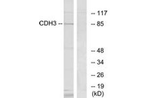 Western blot analysis of extracts from K562 cells, using CDH3 Antibody. (P-Cadherin 抗体  (AA 51-100))