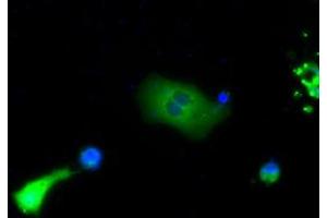 Immunofluorescence (IF) image for anti-Bruton Agammaglobulinemia tyrosine Kinase (BTK) antibody (ABIN1496975) (BTK 抗体)