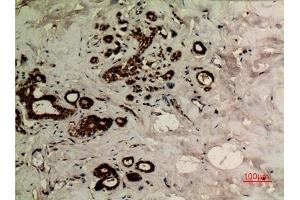 Immunohistochemical analysis of paraffin-embedded human-breast, antibody was diluted at 1:100. (alpha Tubulin 抗体  (acLys40))