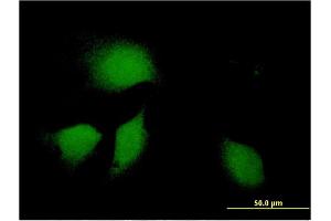 Immunofluorescence of monoclonal antibody to DNAJB9 on HeLa cell. (DNAJB9 抗体  (AA 114-223))
