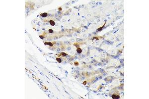 Immunohistochemistry (IHC) image for anti-Secretagogin, EF-Hand Calcium Binding Protein (SCGN) antibody (ABIN7270178)