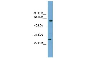 WB Suggested Anti-GZMA Antibody Titration: 0. (GZMA 抗体  (C-Term))