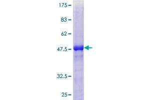 TIMP4 Protein (AA 1-224) (GST tag)