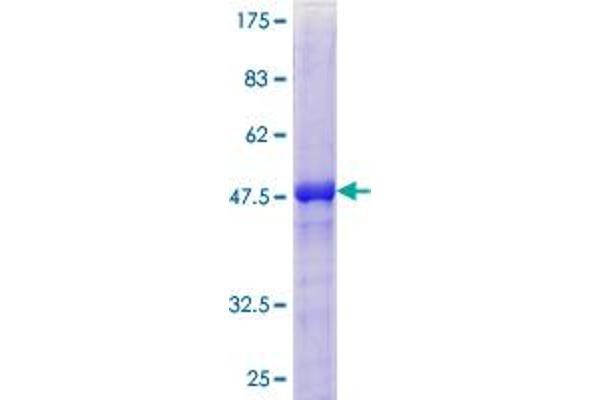 TIMP4 Protein (AA 1-224) (GST tag)