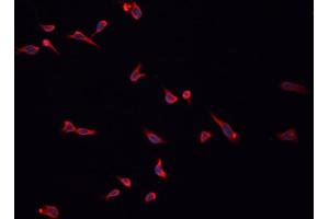 ABIN6276902 staining HepG2? (HSD3B2 抗体)
