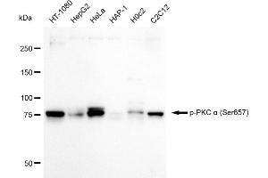 anti-Protein Kinase C, alpha (PKCa) (pSer657) antibody