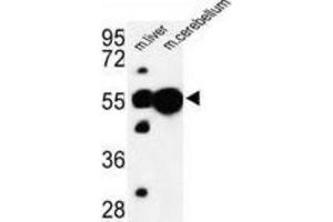 Western Blotting (WB) image for anti-Ubiquitin Associated Protein 1 (UBAP1) antibody (ABIN3003932) (UBAP1 抗体)