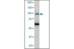 Western Blotting (WB) image for anti-Oculocerebrorenal Syndrome of Lowe (OCRL) (AA 146-240) antibody (ABIN782420) (OCRL 抗体  (AA 146-240))