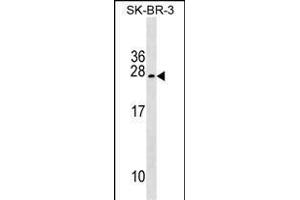 TUSC5 Antibody (Center) (ABIN1538619 and ABIN2849448) western blot analysis in SK-BR-3 cell line lysates (35 μg/lane). (TUSC5 抗体  (AA 78-104))