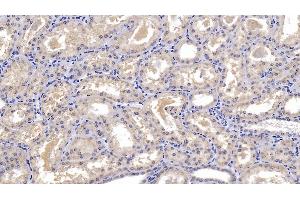 Detection of DBP in Human Kidney Tissue using Monoclonal Antibody to Vitamin D Binding Protein (DBP) (Vitamin D-Binding Protein 抗体  (AA 209-401))