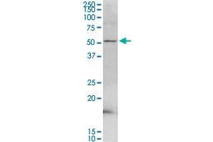 PDE9A MaxPab rabbit polyclonal antibody. (PDE9A 抗体  (AA 1-533))