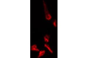 ABIN6274409 staining 293 cells by IF/ICC. (MOBKL1A 抗体  (N-Term))