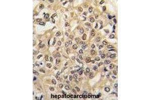Immunohistochemistry (IHC) image for anti-E1 Ubiquitin antibody (ABIN3001449) (E1 Ubiquitin 抗体)