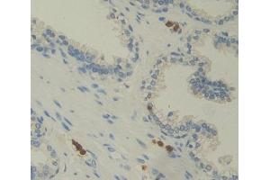 #VALUE! (Photoreceptor Cell Specific Nuclear Receptor 抗体  (AA 1-410))