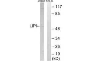 Western blot analysis of extracts from COLO cells, using LIPI Antibody. (Lipase I 抗体  (AA 289-338))