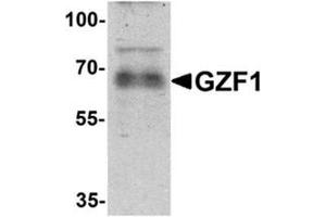 Western blot analysis of GZF1 in human heart tissue lysate with GZF1/ZNF336 Antibody  at 1 µg/ml. (ZNF336 抗体  (C-Term))