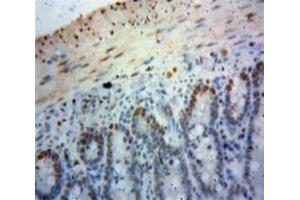 Used in DAB staining on fromalin fixed paraffin-embedded Bowels tissue (SIRT6 抗体  (AA 35-274))
