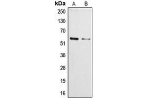 Western blot analysis of Cytochrome P450 3A4/5 expression in NCIH460 (A), HepG2 (B) whole cell lysates. (Cytochrome P450 3A4, 3A5 (Center) 抗体)