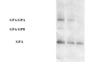 Western blot analysis using AP31671PU-N (Purified Anti-Glycophorin A pAb) at a dilution of 1/100 on human RBCs at various concentrations (GPA = Glycophorin A, GPB = Glycophorin B). (CD235a/GYPA 抗体)