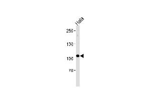 UBE3C Antibody (Center) (ABIN1881969 and ABIN2843383) western blot analysis in Hela cell line lysates (35 μg/lane). (UBE3C 抗体  (AA 549-578))