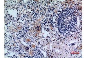 Immunohistochemistry (IHC) analysis of paraffin-embedded Human Lung, antibody was diluted at 1:100. (Transferrin Receptor 抗体  (N-Term))