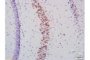 Formalin-fixed and paraffin embedded mouse hippocampus labeled with Anti- KLK10 Polyclonal Antibody, Unconjugated (ABIN741630) at 1:200 followed by conjugation to the secondary antibody