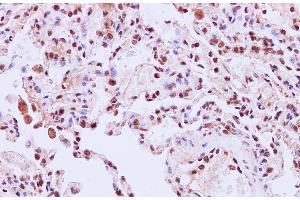 Immunohistochemistry of paraffin-embedded Human lung using STIL Polyclonal Antibody at dilution of 1:200 (STIL 抗体)