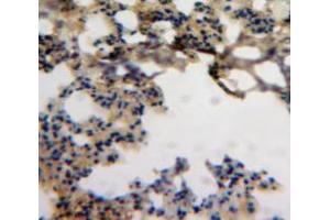 Used in DAB staining on fromalin fixed paraffin-embedded Lung tissue (CCL18 抗体  (AA 21-89))