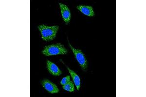 Confocal immunofluorescent analysis of D Kinase 1 (DK1) Antibody (C-term) 7217b with A549 cell followed by Alexa Fluor® 489-conjugated goat anti-rabbit lgG (green).