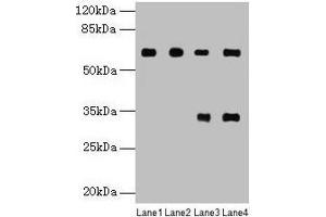 Western blot All lanes: PGM1 antibody at 6 μg/mL Lane 1: U251 whole cell lysate Lane 2: U937 whole cell lysate Lane 3: Jurkat whole cell lysate Lane 4: Hela whole cell lysate Secondary Goat polyclonal to rabbit IgG at 1/10000 dilution Predicted band size: 62, 64, 41 kDa Observed band size: 62 kDa (Phosphoglucomutase 1 抗体  (AA 1-562))