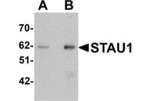 Western blot analysis of STAU1 in rat brain tissue lysate with STAU1 antibody at (A) 1 and (B) 2 μg/ml. (STAU1/Staufen 抗体  (C-Term))