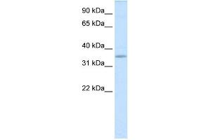 WB Suggested Anti-TGIFX1 Antibody Titration:  0. (TGIF2LX 抗体  (Middle Region))