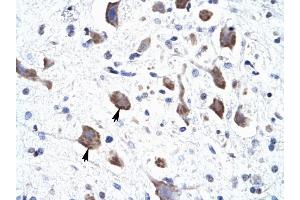 CLCN3 antibody was used for immunohistochemistry at a concentration of 4-8 ug/ml to stain Neural cells (arrows) in Human Brain. (CLCN3 抗体  (C-Term))
