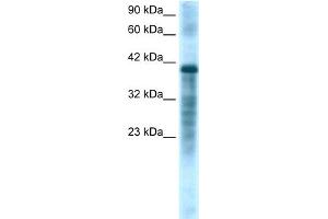 Western Blotting (WB) image for anti-Proteasome (Prosome, Macropain) 26S Subunit, ATPase, 3 (PSMC3) (Middle Region) antibody (ABIN2777668)