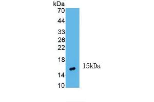 Detection of Recombinant INHbA, Human using Monoclonal Antibody to Inhibin Beta A (INHbA) (INHBA 抗体  (AA 311-426))