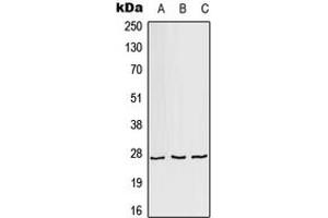Western blot analysis of AKR1A1 expression in HeLa (A), Raw264. (AKR1A1 抗体  (C-Term))