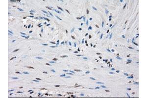 Immunohistochemical staining of paraffin-embedded endometrium tissue using anti-IDH1 mouse monoclonal antibody. (IDH1 抗体)