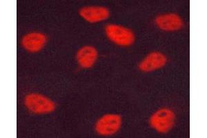 ABIN6267678 staining HUVEC cells by ICC/IF. (ESR2 抗体  (pSer105))