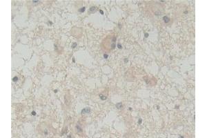 Immunohistochemistry (IHC) image for anti-Abl-Interactor 1 (ABI1) (AA 1-182) antibody (ABIN7436735)