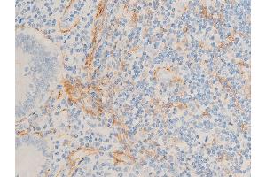 Immunohistochemistry (IHC) image for anti-Actin, alpha 2, Smooth Muscle, Aorta (ACTA2) (N-Term) antibody (ABIN6254917)