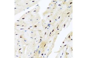 Immunohistochemistry of paraffin-embedded mouse heart using ZBTB17 antibody at dilution of 1:100 (x40 lens). (ZBTB17 抗体)