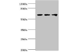 Western blot All lanes: Probable ATP-dependent RNA helicase DDX5 antibody at 3 μg/mL Lane 1: NIH/3T3 whole cell lysate Lane 2: Hela whole cell lysate Lane 3: 293T whole cell lysate Secondary Goat polyclonal to rabbit IgG at 1/10000 dilution Predicted band size: 70, 61 kDa Observed band size: 70 kDa (DDX5 抗体  (AA 1-290))