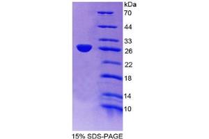 SDS-PAGE analysis of Mouse Apolipoprotein A4 Protein. (APOA4 蛋白)