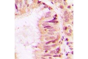 Immunohistochemistry (IHC) image for anti-Serpin Family H Member 1 (SERPINH1) antibody (ABIN7308322)