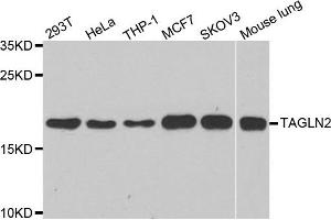 Western blot analysis of extracts of various cell lines, using TAGLN2 antibody. (TAGLN2 抗体)