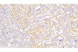 Detection of VCL in Mouse Kidney Tissue using Polyclonal Antibody to Vinculin (VCL) (Vinculin 抗体  (AA 879-1064))