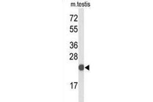 Western Blotting (WB) image for anti-CXXC Finger Protein 4 (CXXC4) (AA 164-194), (C-Term) antibody (ABIN951745)