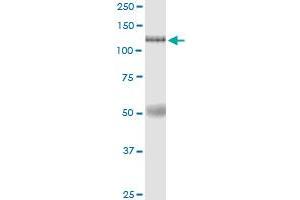 Immunoprecipitation (IP) image for anti-Eukaryotic Translation Initiation Factor 4E Nuclear Import Factor 1 (EIF4ENIF1) (AA 1-985) antibody (ABIN949504)