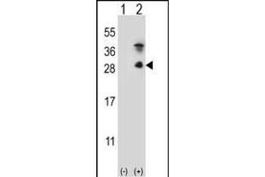 Western blot analysis of KLK7 (arrow) using rabbit polyclonal KLK7 Antibody  (ABIN652198 and ABIN2840744). (Kallikrein 7 抗体  (C-Term))